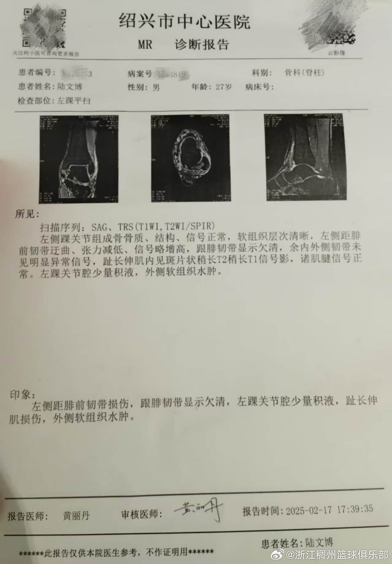送球迷的创